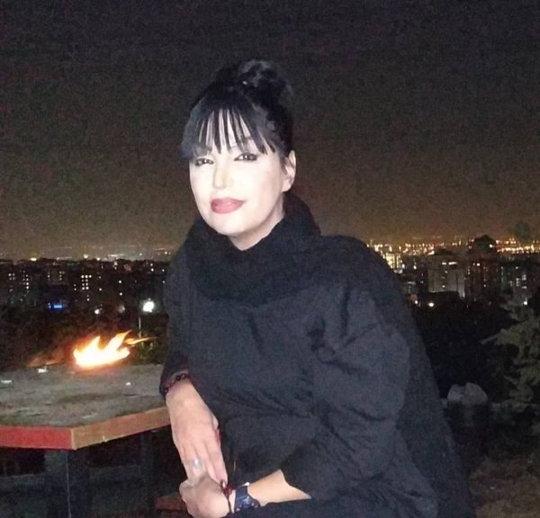 اعانه ی حدقه